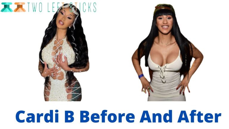 Cardi B Before And After- Her Cosmetic Surgery Revealed!
