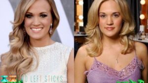 Carrie Underwood Before and After-twoleftsticks(3)
