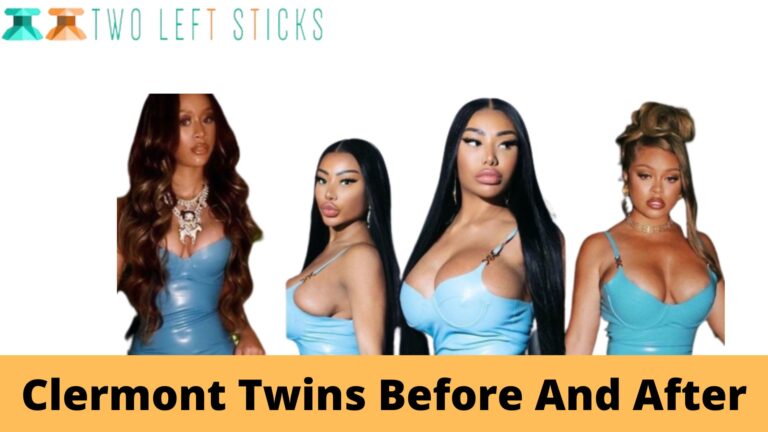 Clermont Twins Before And After- Which of the Twins is more obviously altered by plastic surgery?