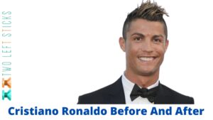 Cristiano Ronaldo Before And After-twoleftsticks(1)