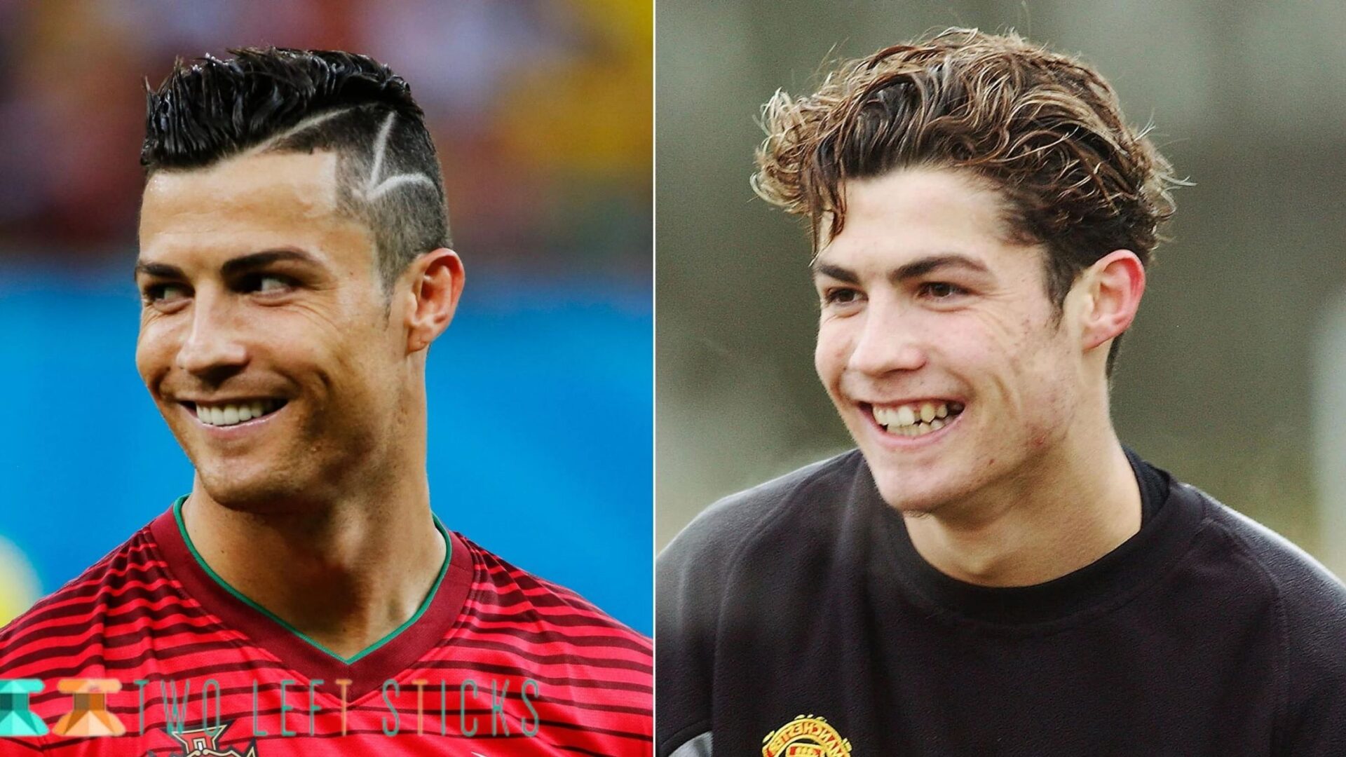 Cristiano Ronaldo Before And After- His Plastic Surgery Secrets Revealed!