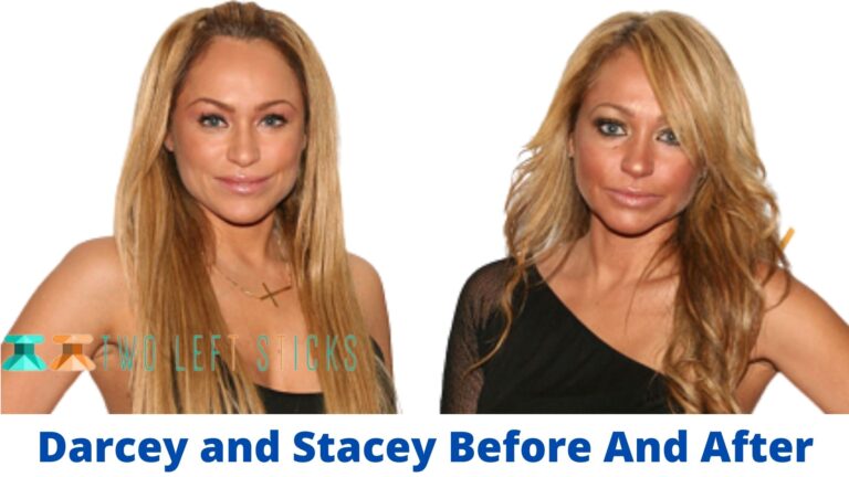Darcey and Stacey Before And After- After Stunning Cosmetic Surgery, no longer Recognizably Them.