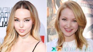 Dove Cameron Before and After-twoleftsticks(4)