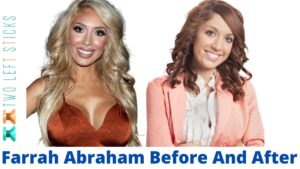 Farrah Abraham Before And After-twoleftsticks(1)