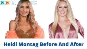 Heidi Montag Before And After-twoleftsticks(1)