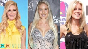 Heidi Montag Before And After-twoleftsticks(2)