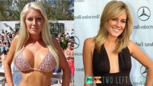 Heidi Montag Before And After-twoleftsticks(4)
