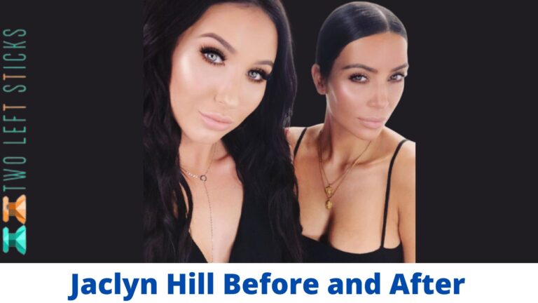 Jaclyn Hill Before and After- When Her Appearance Is Criticized, She Responds with Filtered Photos