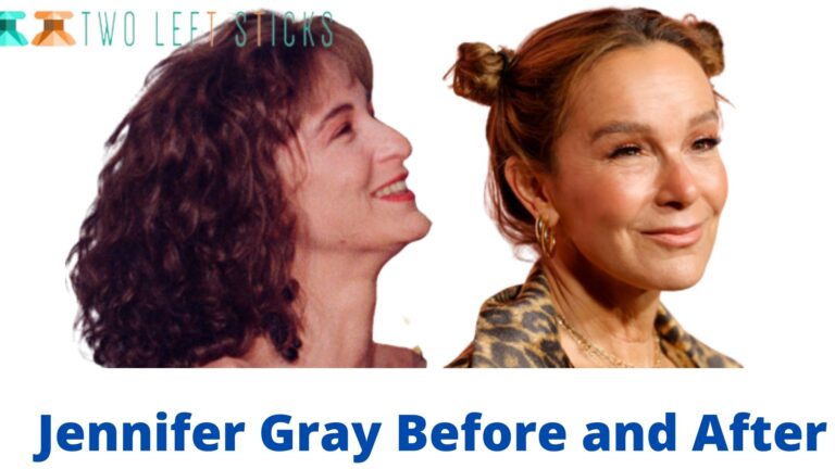 Jennifer Gray Before and After- Her Plastic Surgery Hurt her Career.