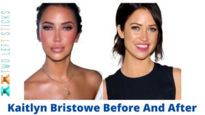 Kaitlyn Bristowe Before And After-twoleftsticks(1)
