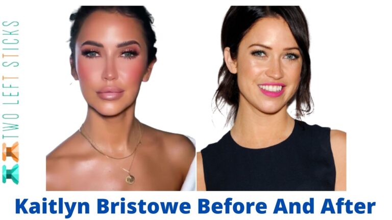 Kaitlyn Bristowe Before And After- She Has Openly Discussed Her Cosmetic Treatments.