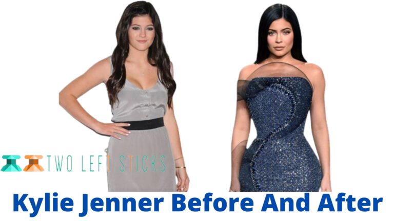 Kylie Jenner Before And After- The Evolution of Her Looks Over the Years.
