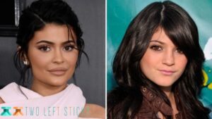 Kylie Jenner Before And After-twoleftsticks(2)