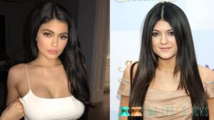 Kylie Jenner Before And After-twoleftsticks(3)