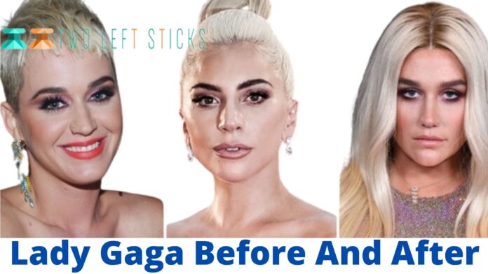 Lady Gaga Before And After-twoleftsticks(1)