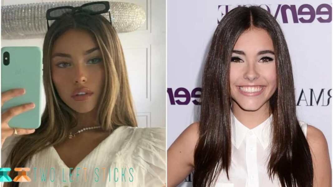 Madison Beer Before And After Did She Get Plastic Surgery