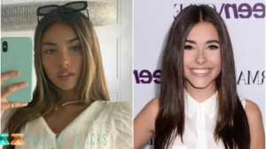 Madison Beer Before And After-twoleftsticks(4)