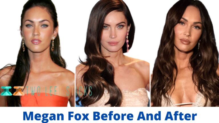 Megan Fox Before And After- Has She Undergone Plastic Surgery?