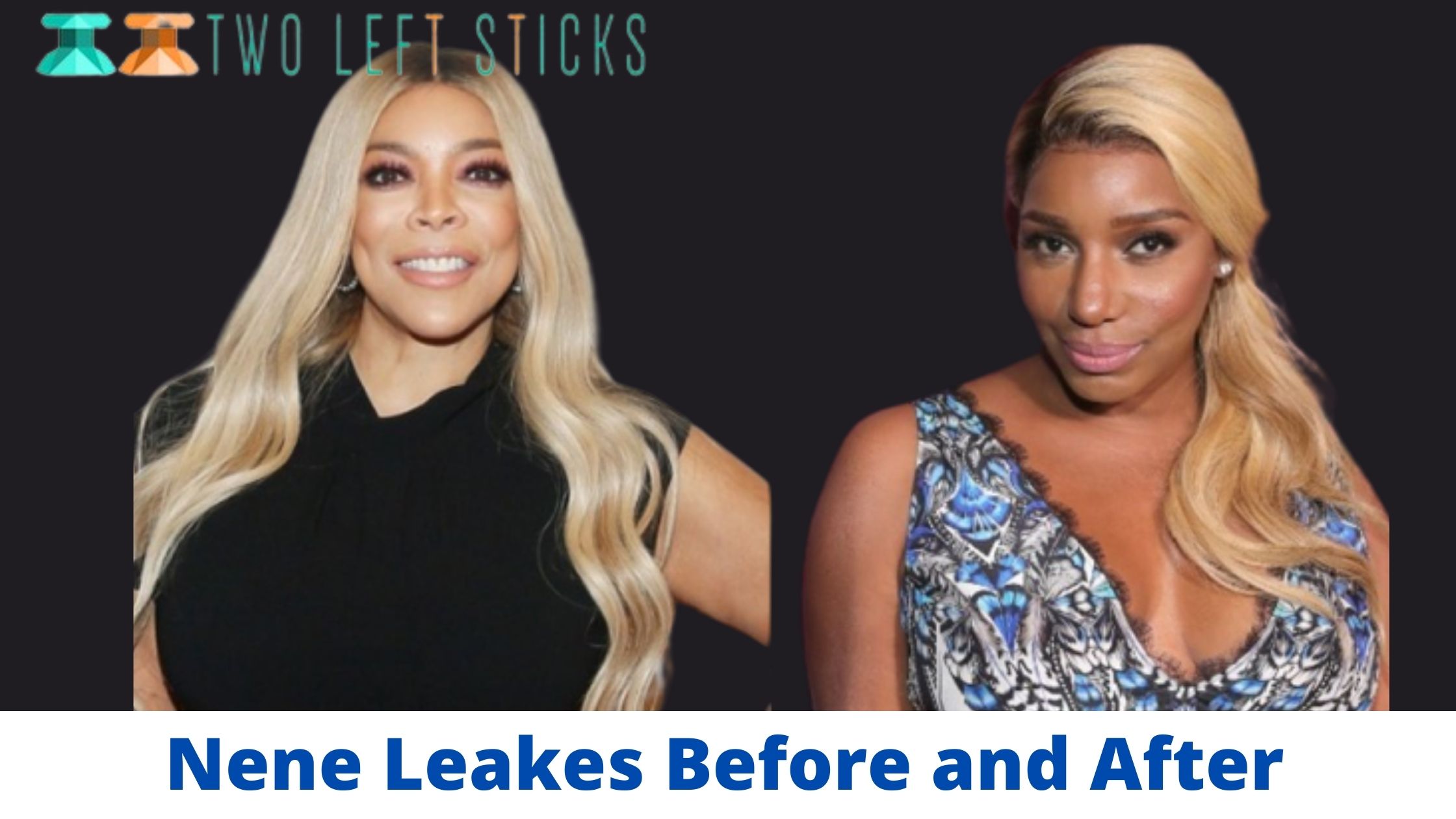 Nene Leakes Before and After- Is She Still Interested in Having Plastic Surgery?