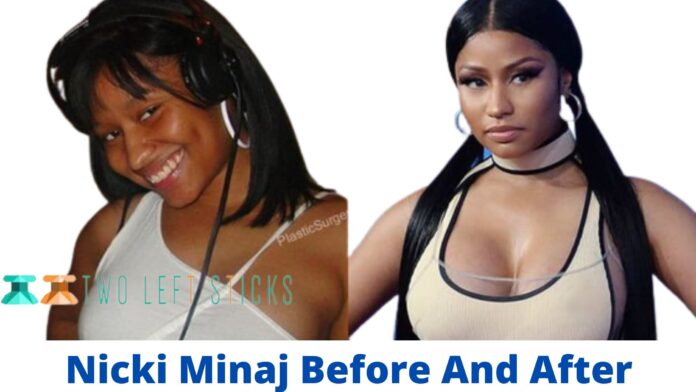 Nicki Minaj Before And After-twoleftsticks(1)