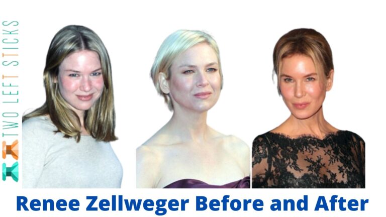 Renee Zellweger Before and After- Her response to rumors of Plastic Surgery.
