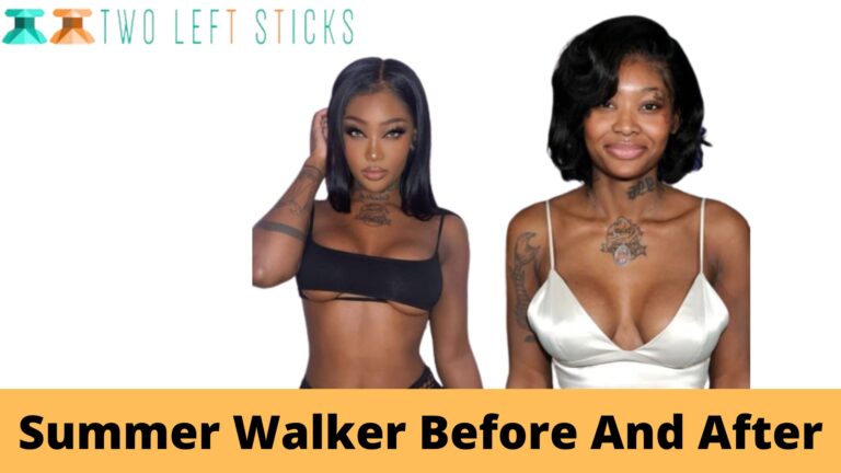 Summer Walker Before And After- The Singer Before and After Plastic Surgery!