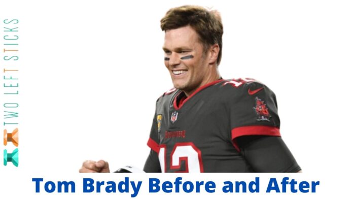 Tom Brady Before and After-twoleftsticks(1)