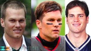 Tom Brady Before and After-twoleftsticks(5)