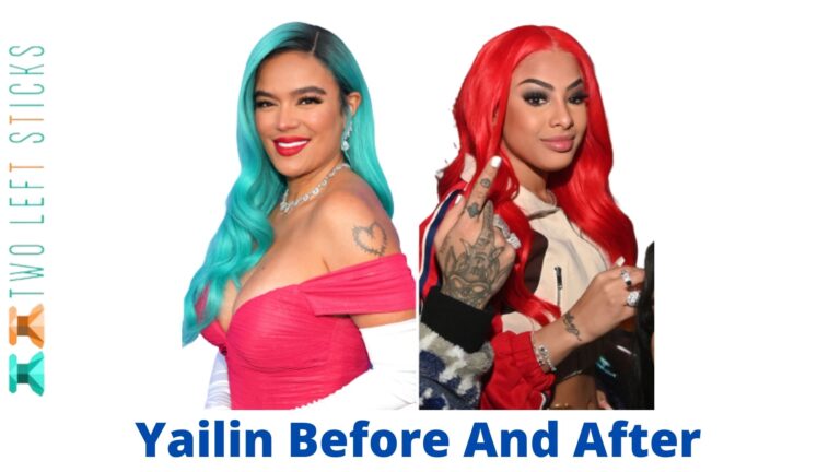 Yailin Before And After- Learn More About Singer Surgery!