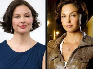what happened to ashley judd face
